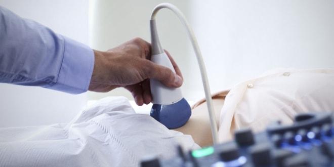 УЗИ кисты жёлтого тела яичника