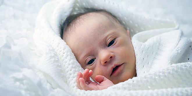 Синдром Дауна у новорождённого ребёнка