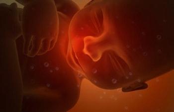 Внутриутробная смерть плода