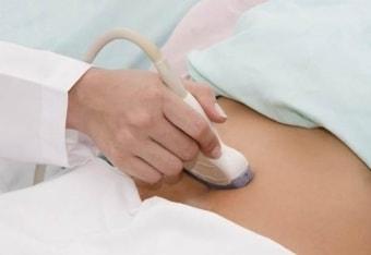Ультразвуковое исследование анэхогенной кисты