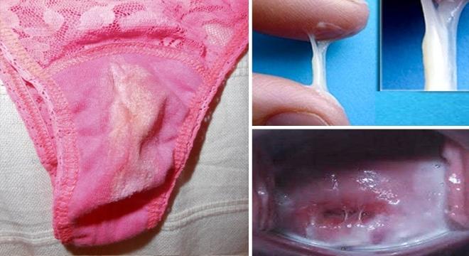 Вагинальные выделения при оофорите