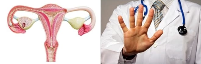 Почему нельзя делать массаж яичников при кисте парных половых желез